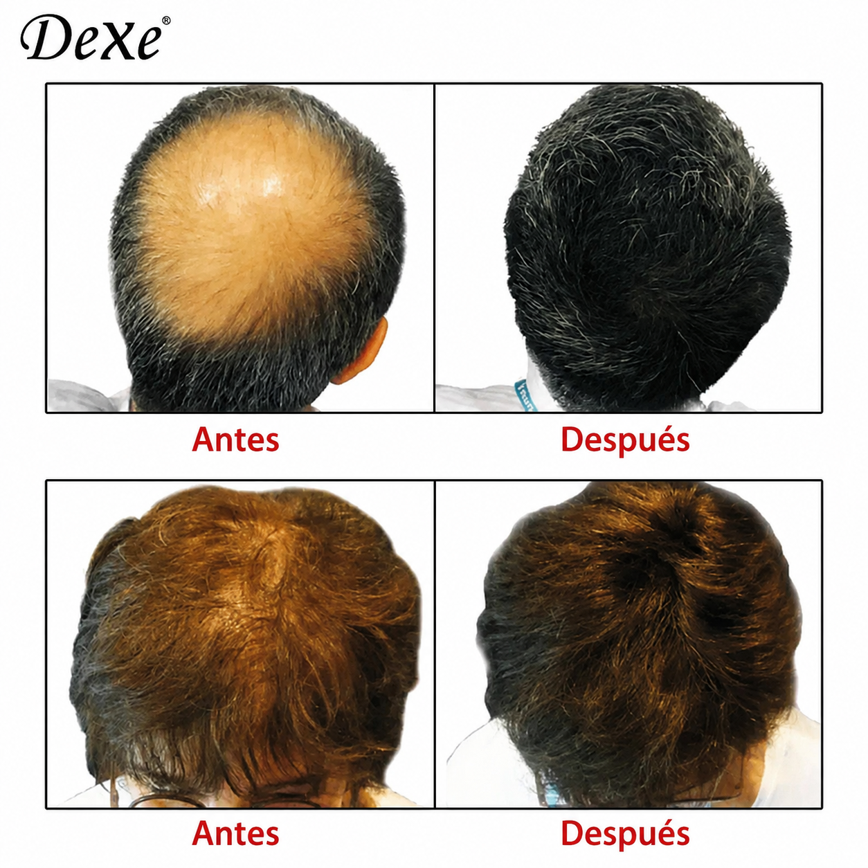 Dexe® Fibras Capilares De Simulación Natural