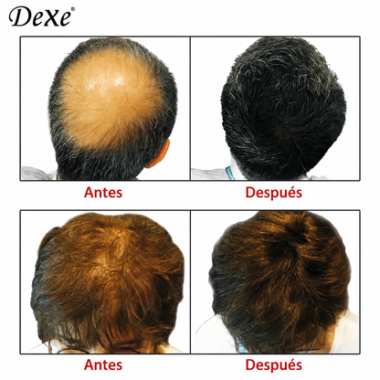 Dexe® Fibras Capilares De Simulación Natural